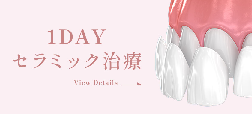 1DAYセラミック治療